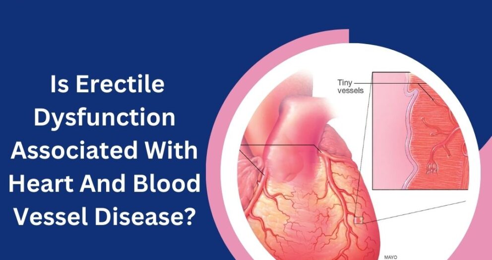 is erectile dysfunction associated with heart and blood vessel disease