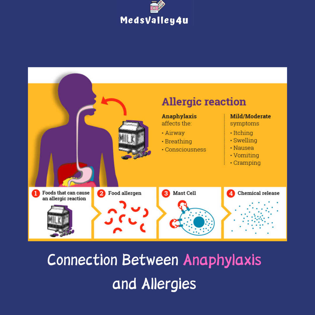 Connection Between Anaphylaxis and Allergies.