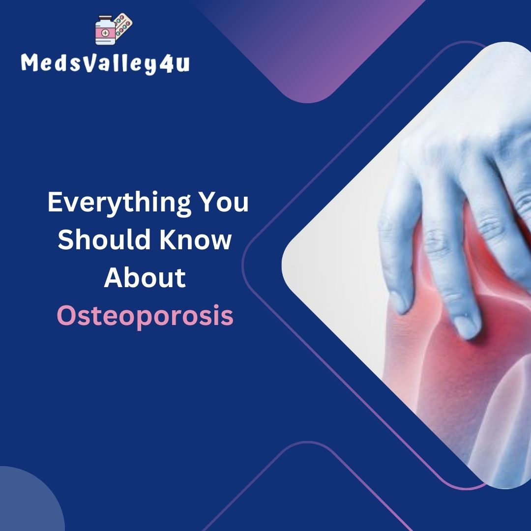 Everything You Should Know About Osteoporosis