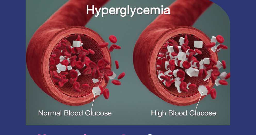Hyperglycemia – Symptoms, Causes & Risk Factors.