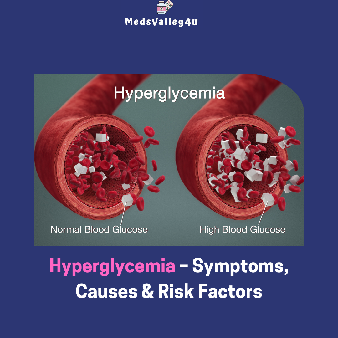 Hyperglycemia – Symptoms, Causes & Risk Factors.