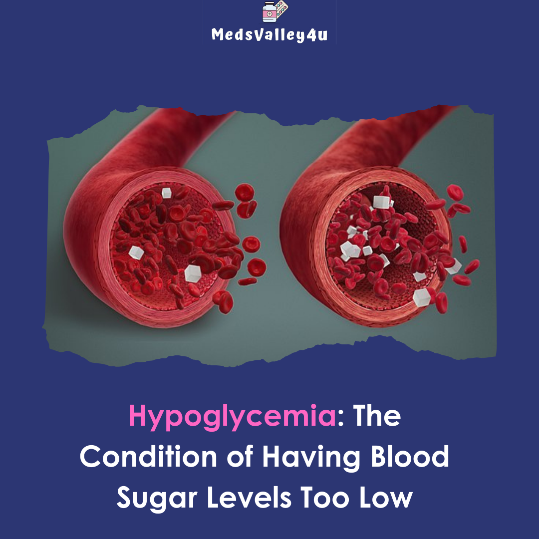 Hypoglycemia: The Condition of Having Blood Sugar Levels Too Low.