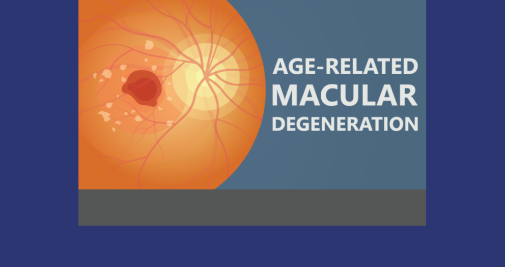The Interaction Among Aging and Increased AMD Risk.